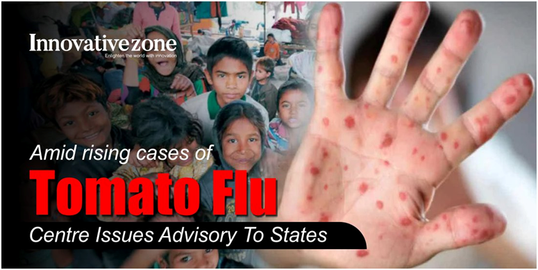 Centre issued an advisory for ‘Tomato flu’ (GS Paper 3, Science and Tech)